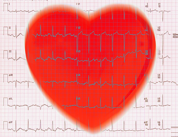 EKG & Red Heart
